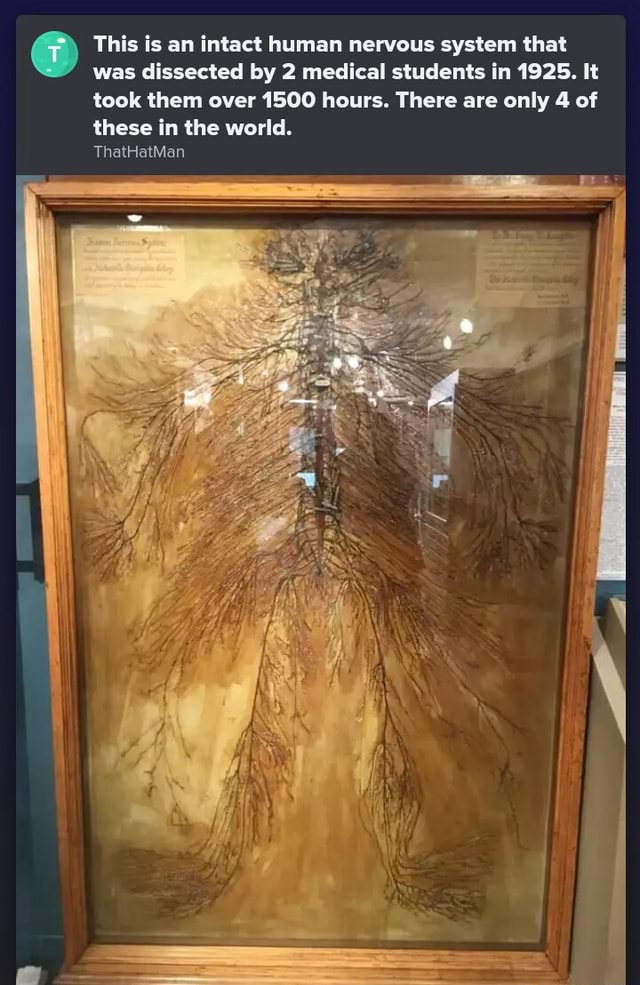 This Is An Intact Human Nervous System That Was Dissected By Medical