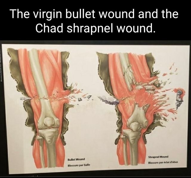 The Virgin Bullet Wound And The Chad Shrapnel Wound IFunny