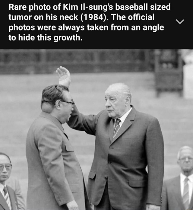 Rare Photo Of Kim Il Sung S Baseball Sized Tumor On His Neck