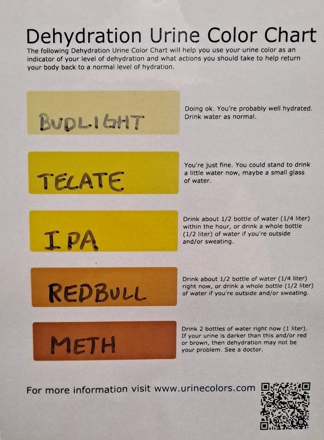 Dehydration Urine Color Chart The Following Dehydration Urine Color