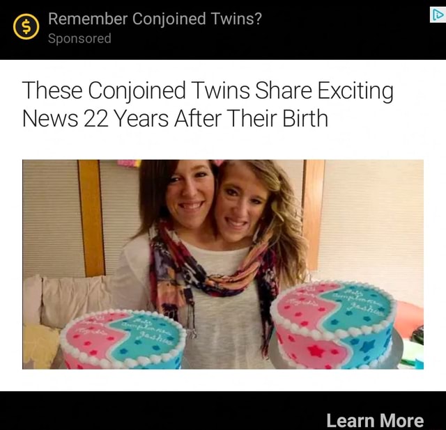 Remember Conjoined Twins Sponsored These Conjoined Twins Share