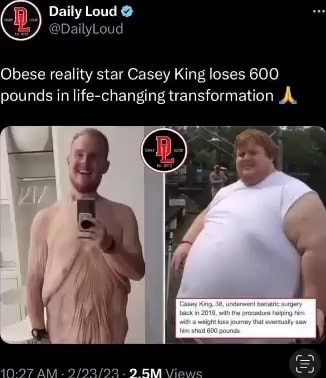 Obese Reality Star Casey King Loses Pounds In Life Changing