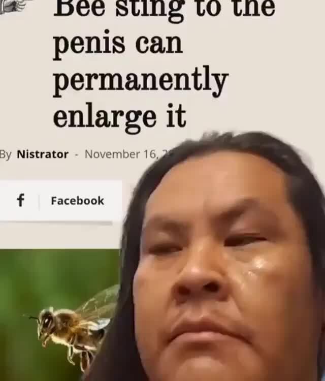 Bee Sting To The Penis Can Permanently Enlarge It By Nistrator