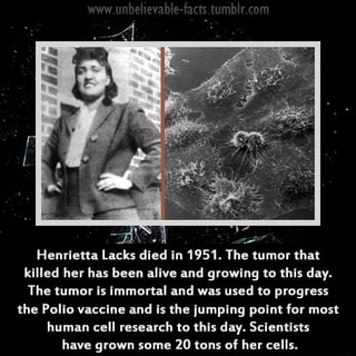 lacks henrietta tumor immortal ifunny