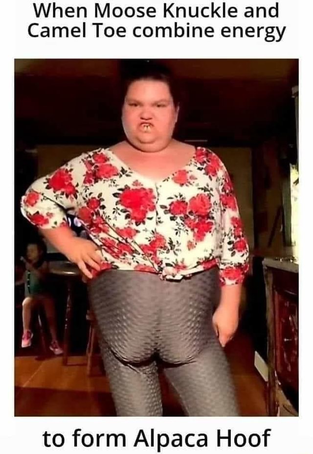 When Moose Knuckle And Camel Toe Combine Energy To Form Alpaca Hoof 