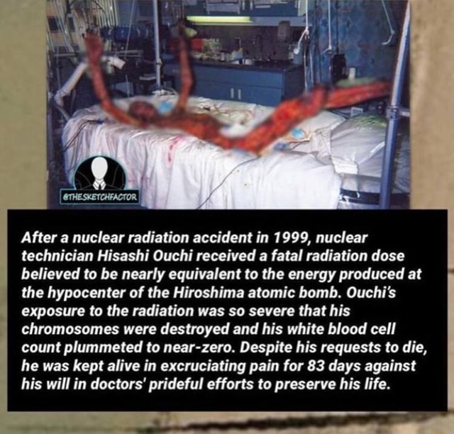 After a nuclear radiation accident in 1999, nuclear technician Hisashi