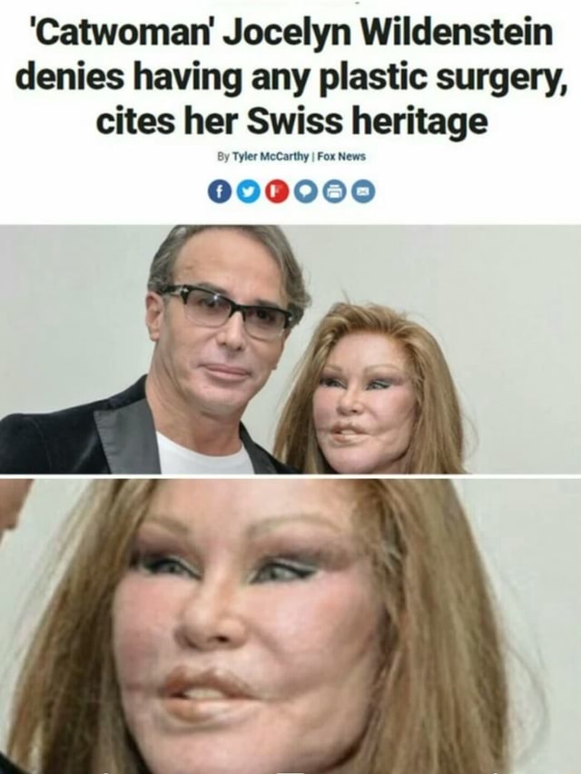 Catwoman Jocelyn Wildenstein Denies Having Any Plastic Surgery Cites