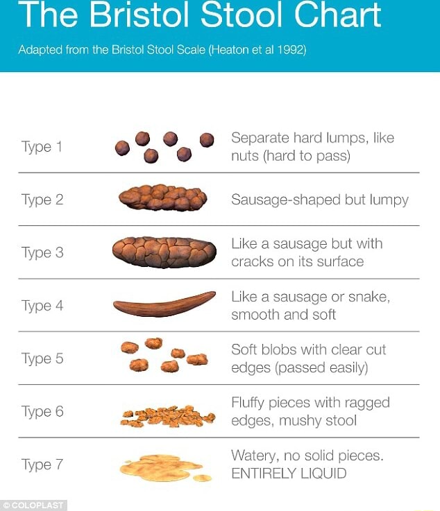 The Bristol Stool Chart Adapted from the Bristol Stool Scale (Heaton et