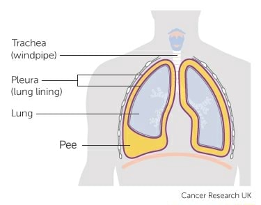 Trachea (windpipe) Pleura (lung lining) Lung - iFunny