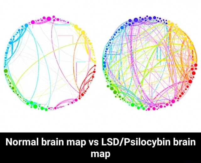 Brain map vs LSD/Psilocybin brain map Normal - Normal brain map vs LSD ...