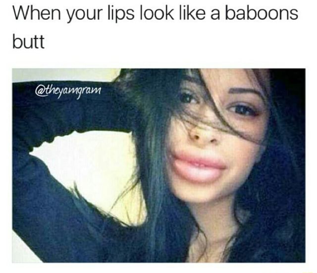 When your lips look like a baboons butt - )