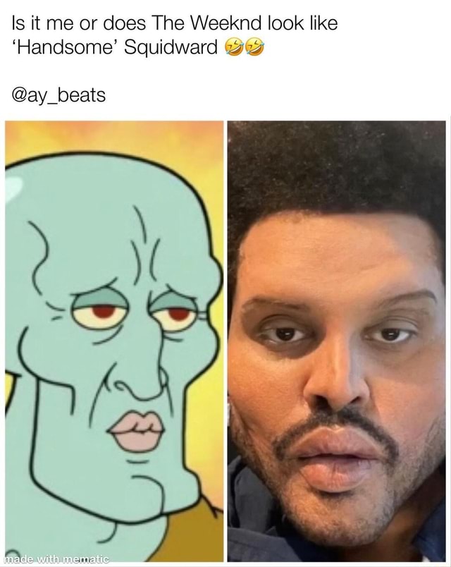 The Weeknd Shocks Fans With Plastic Surgery Look