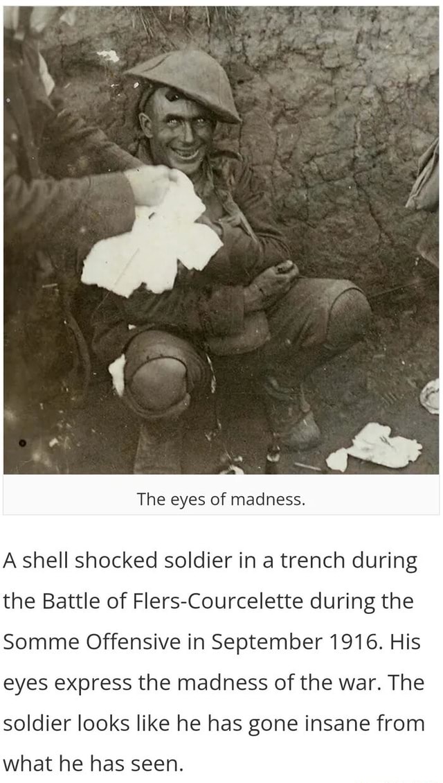 His Eyes Express The Madness Of The War: Shell Shocked Soldier In