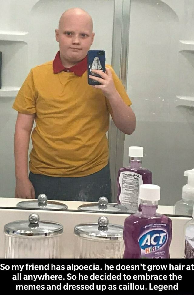 So My Friend Has Alpoecia He Doesn t Grow Hair At All Anywhere So He