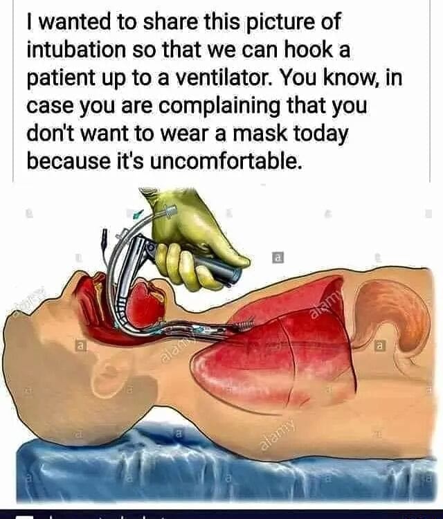 Intubation Porn - I wanted to share this picture of intubation so that we can hook a patient  up to a ventilator. You know, in case you are complaining that you don't  want to wear