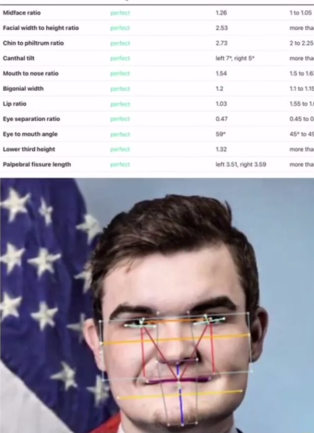 Midtace ratio Facial width to height ratio Chin to philtrum ratio ...