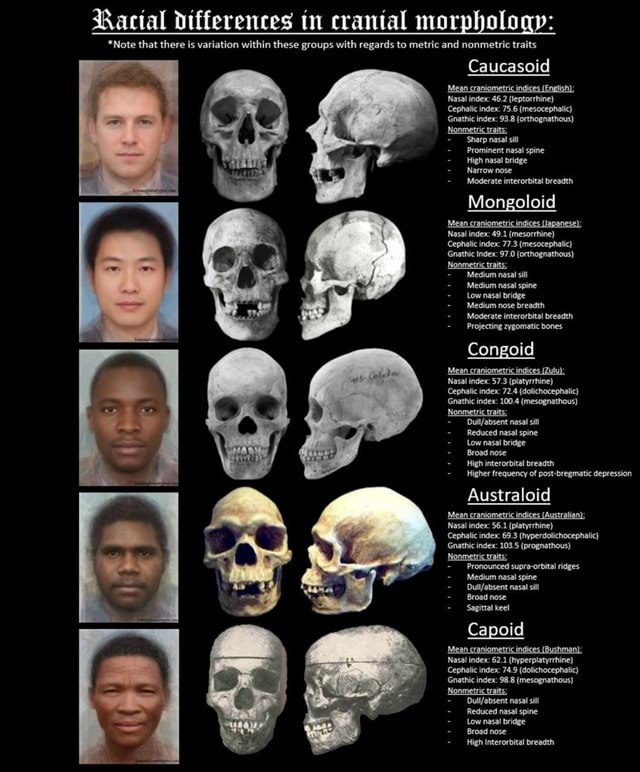 Racial differences in cranial morphology: *Note that there is variation ...