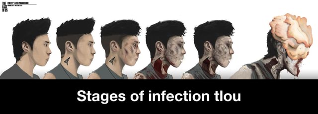 Stages of infection tlou - Stages of infection tlou - )