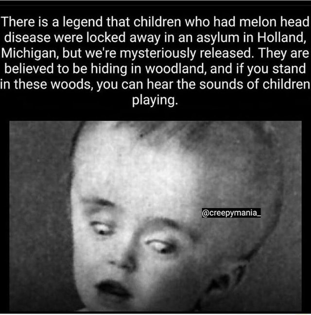 There is a legend that children who had melon head disease were locked