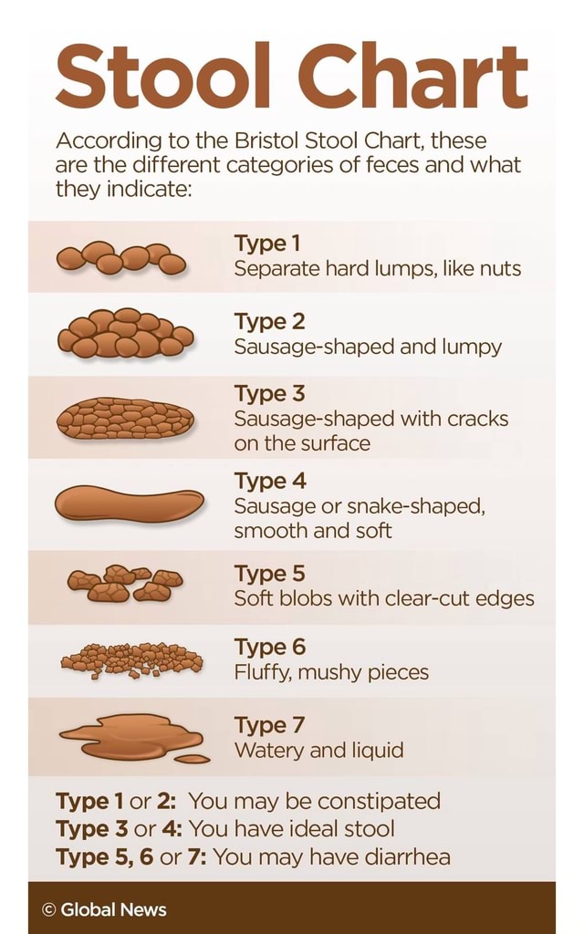 Stool Chart According To The Bristol Stool Chart These Are The 