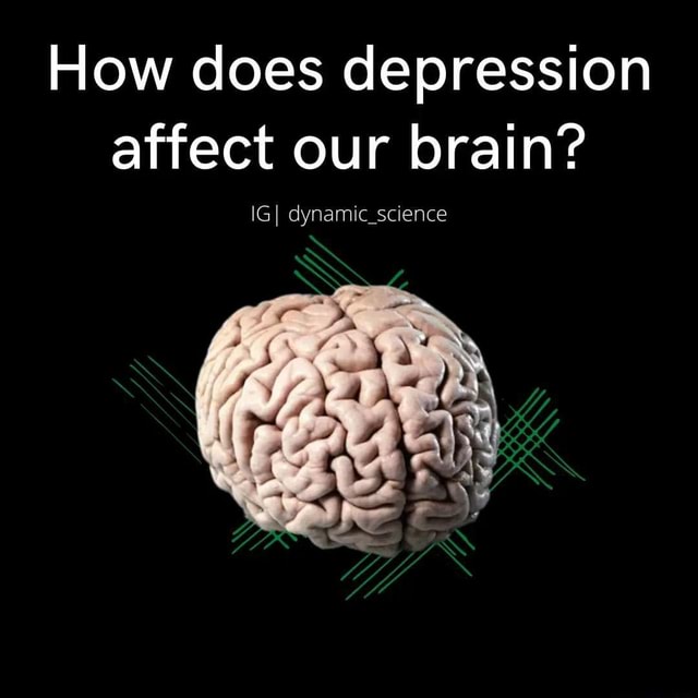 How Does Depression Affect Our Brain? Igi Dynamic Science - Ifunny