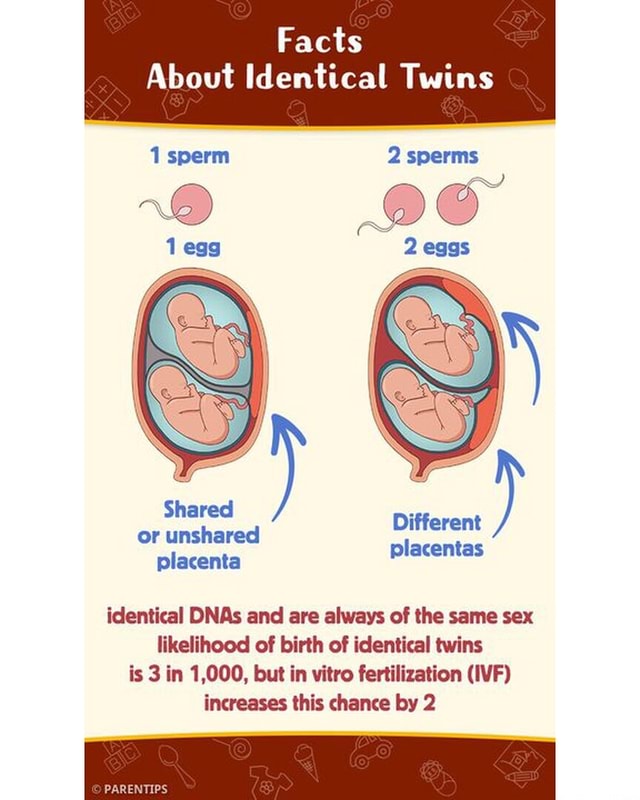 Facts about identical twins brightside learnwithinstagram ...