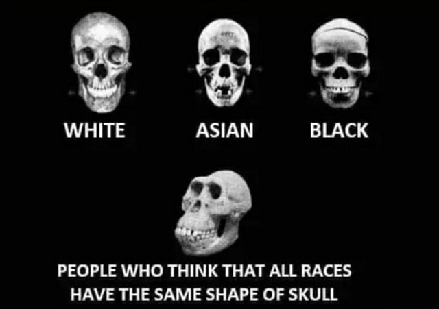 People Who Think That All Races Have The Same Shape Of Skull