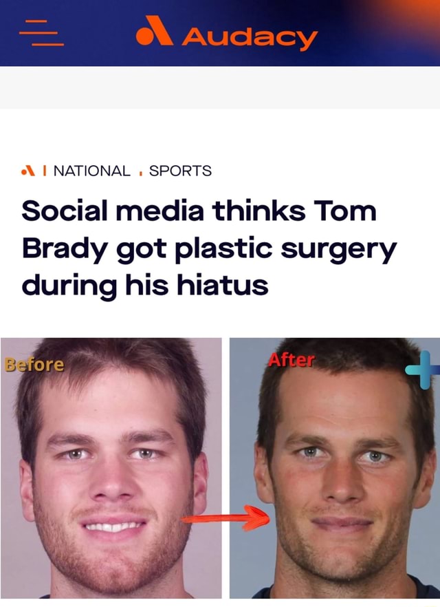 NFL Fans Think Tom Brady Got 'Plastic Surgery' & Roasted His Press  Conference Appearance - Narcity