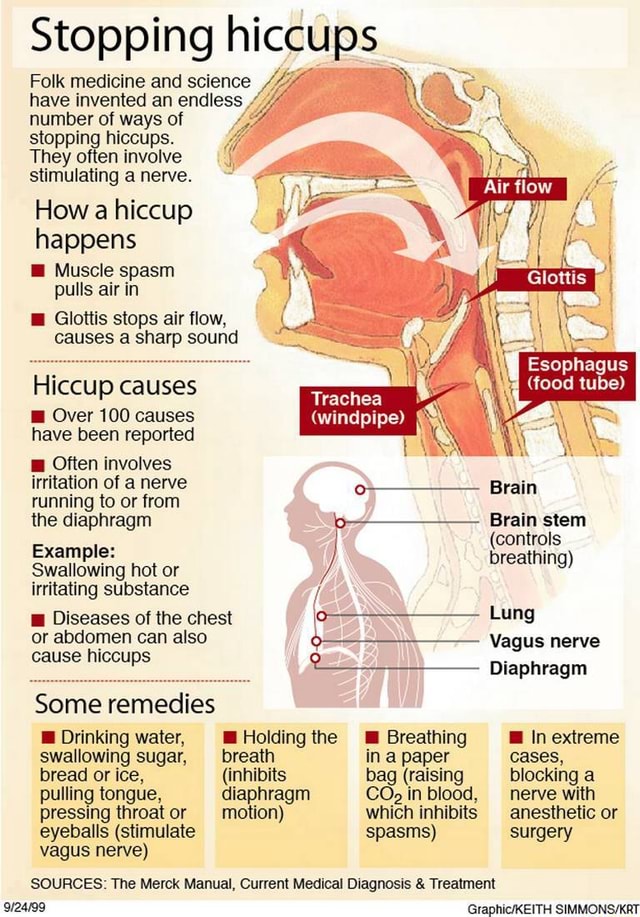 Hiccups; The causes and how to cease them. - Stopping hiccups Folk ...