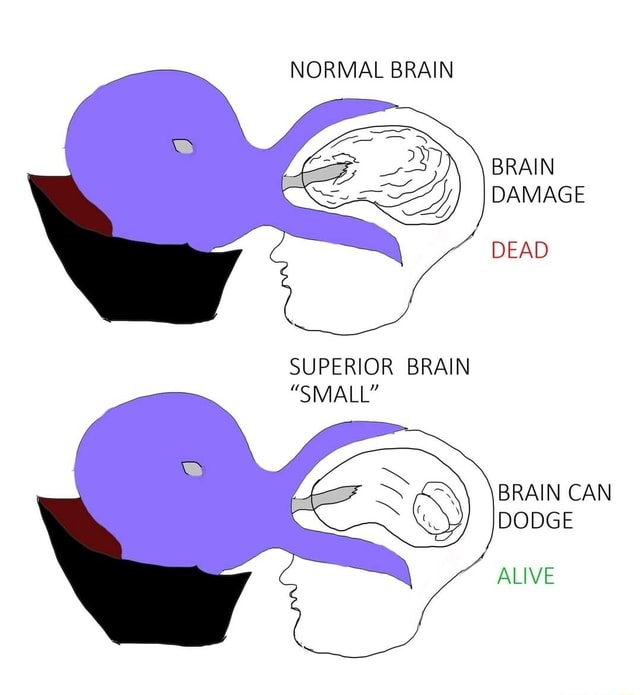 normal-brain-2-superior-brain-small-brain-damage-dead-brain-can