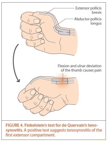 Extensor pollicis brevis 'Abductor pollicis fongus Flexion and ulnar ...