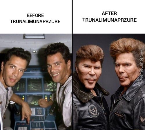 BEFORE AFTER TRUNALIMUNAPRZURE TRUNALIMUNAPRZURE - iFunny