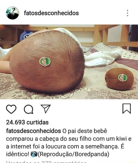 E Fatosdesconhecidos E Fatosdesconhecidos O Pai Deste Bebe Comparou A Cabeca Do Seu Filho Com Um Kiwi E A Internet Foi A Loucura Com A Semelhanca E