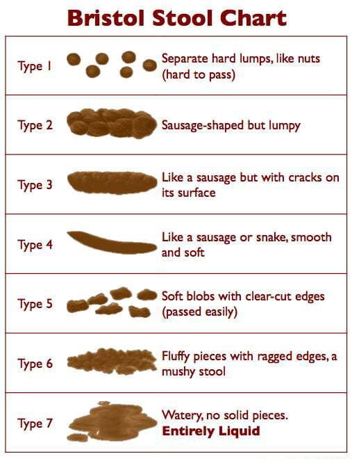 Bristol Stool Chart Separate hard lumps, like nuts Type (hard to pars ...