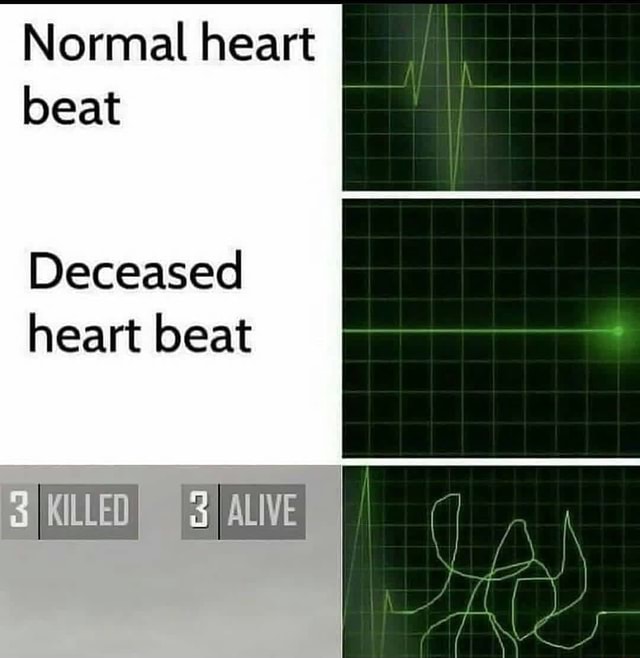 Normal heart beat Deceased heart beat ALE - iFunny