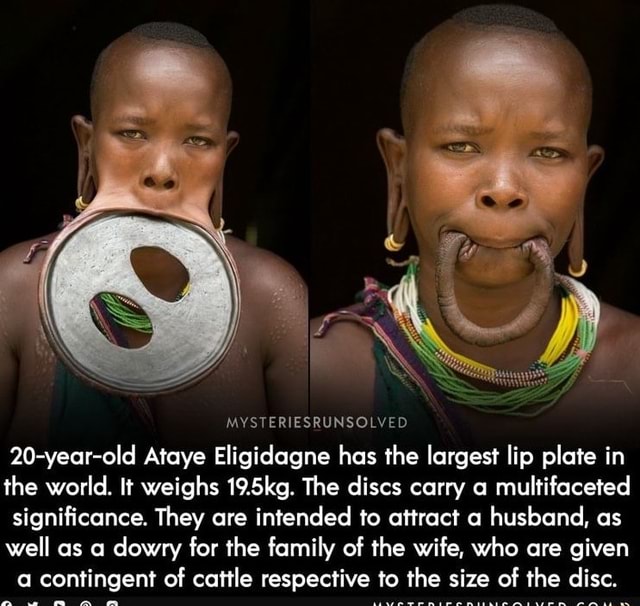 MYSTERIESRUNSOLVED 20yearold Ataye Eligidagne has the largest lip