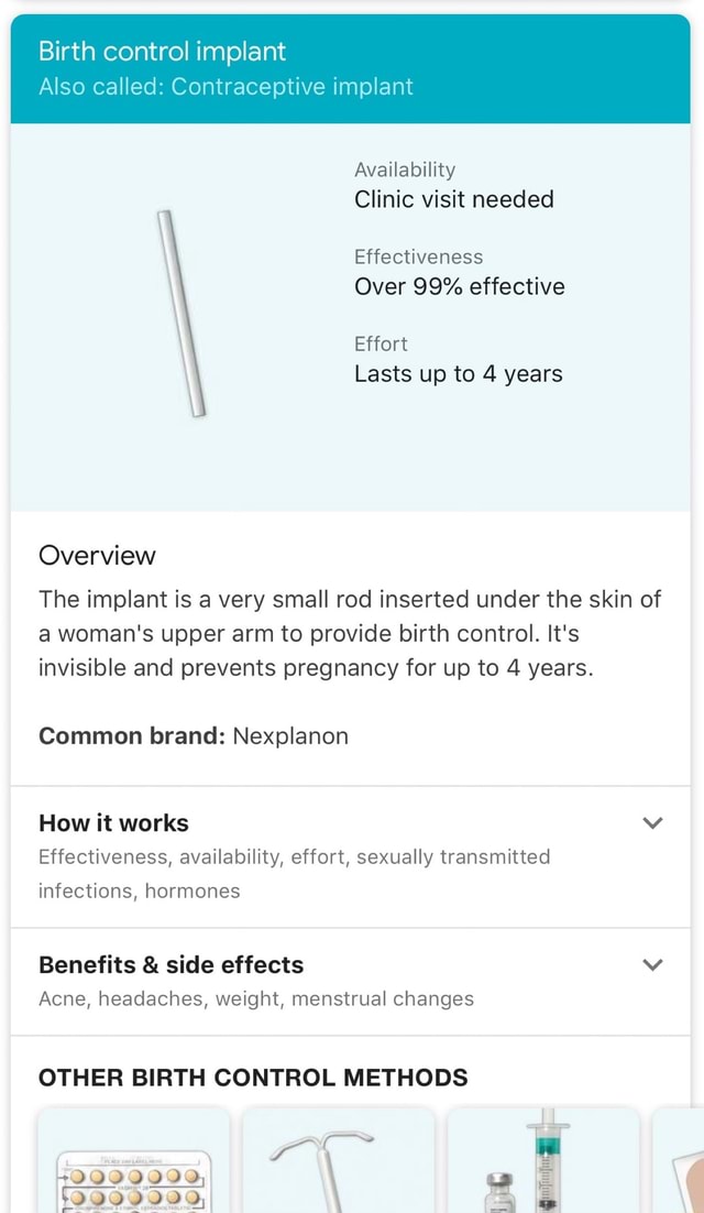 Birth control implant Also called: Contraceptive implant Availability ...
