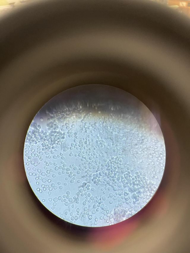 Yeast 1000x microscope/ oil immersion. iFunny