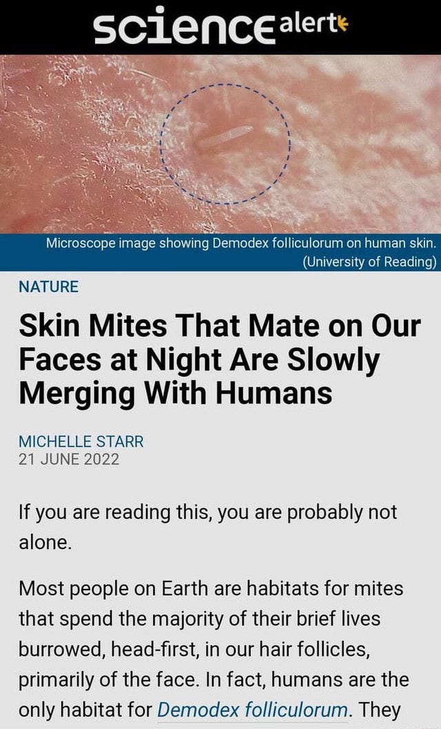 Sciencealert Microscope image ing Demodex folliculorum on human skin. (University of Reading