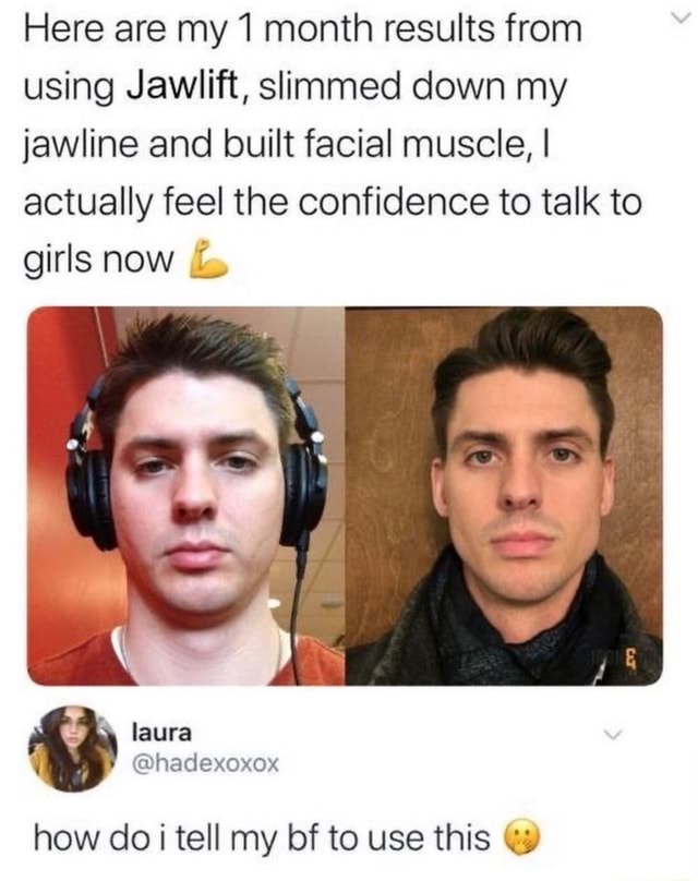 Here are my 1 month results from using Jawlift, slimmed down my jawline ...