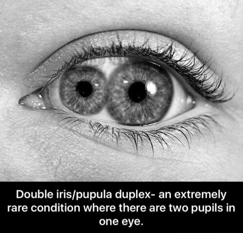 double pupil contacts