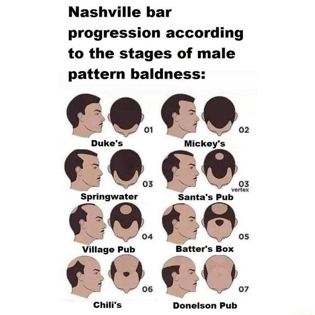 Nashville bar progression according to the stages of male pattern