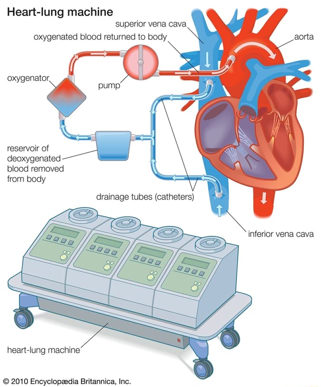 Heartlung machine superior vena cava oxygenated blood returned to body