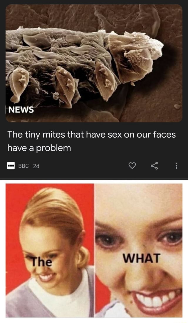 The Tiny Mites That Have Sex On Our Faces Have A Problem I News Bbc The 6725