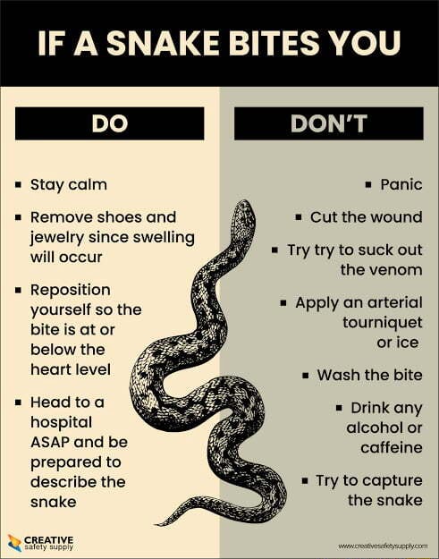 IF A SNAKE BITES YOU Stay calm Panic Remove shoes and jewelry since ...