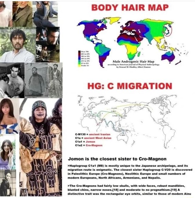 male androgenic hair map        
        <figure class=