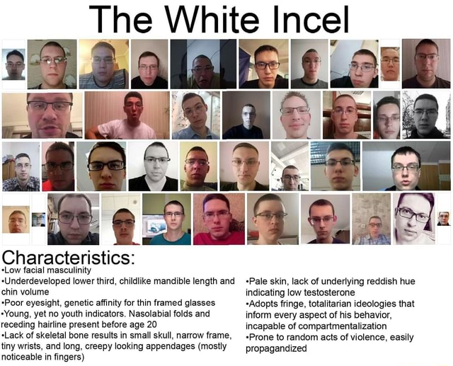 The White Incel -Low facial masculinity -Underdeveloped lower third