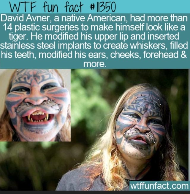 Wtf Fun Fact David Avner A Native American Had More Than 14 Plastic