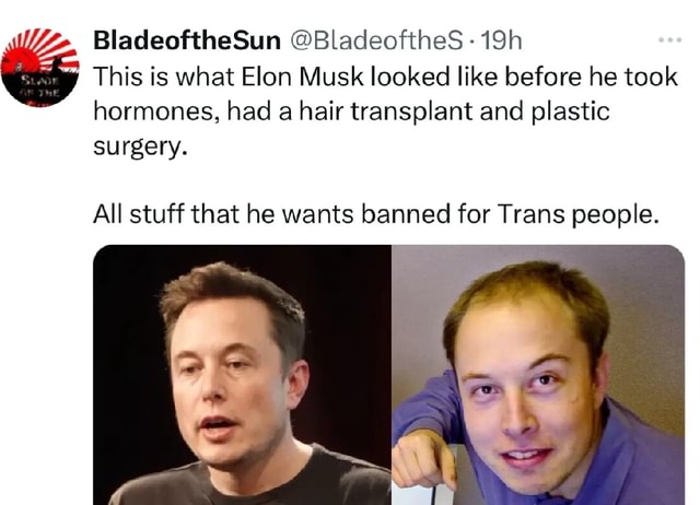 BladeoftheSun BladeoftheS This Is What Elon Musk Looked Like Before He bladeofthesun-bladeofthes-this-is-what-elon-musk-looked-like-before-he