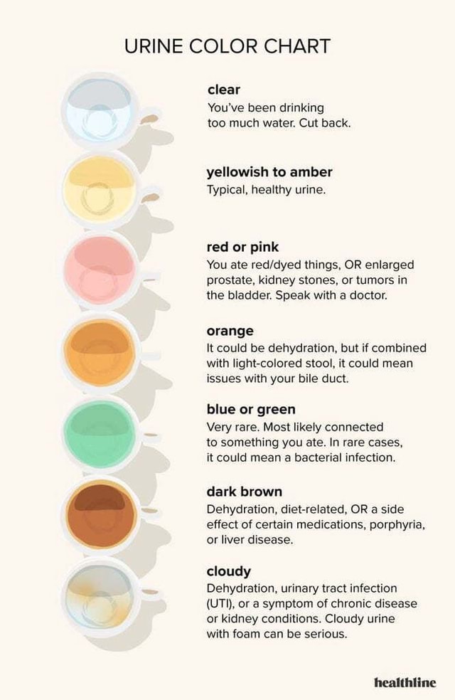 Dehydration Urine Color Chart Infographic Health Nutrition Chart